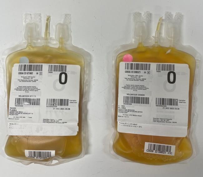 Plasma Lipemia Professional Education